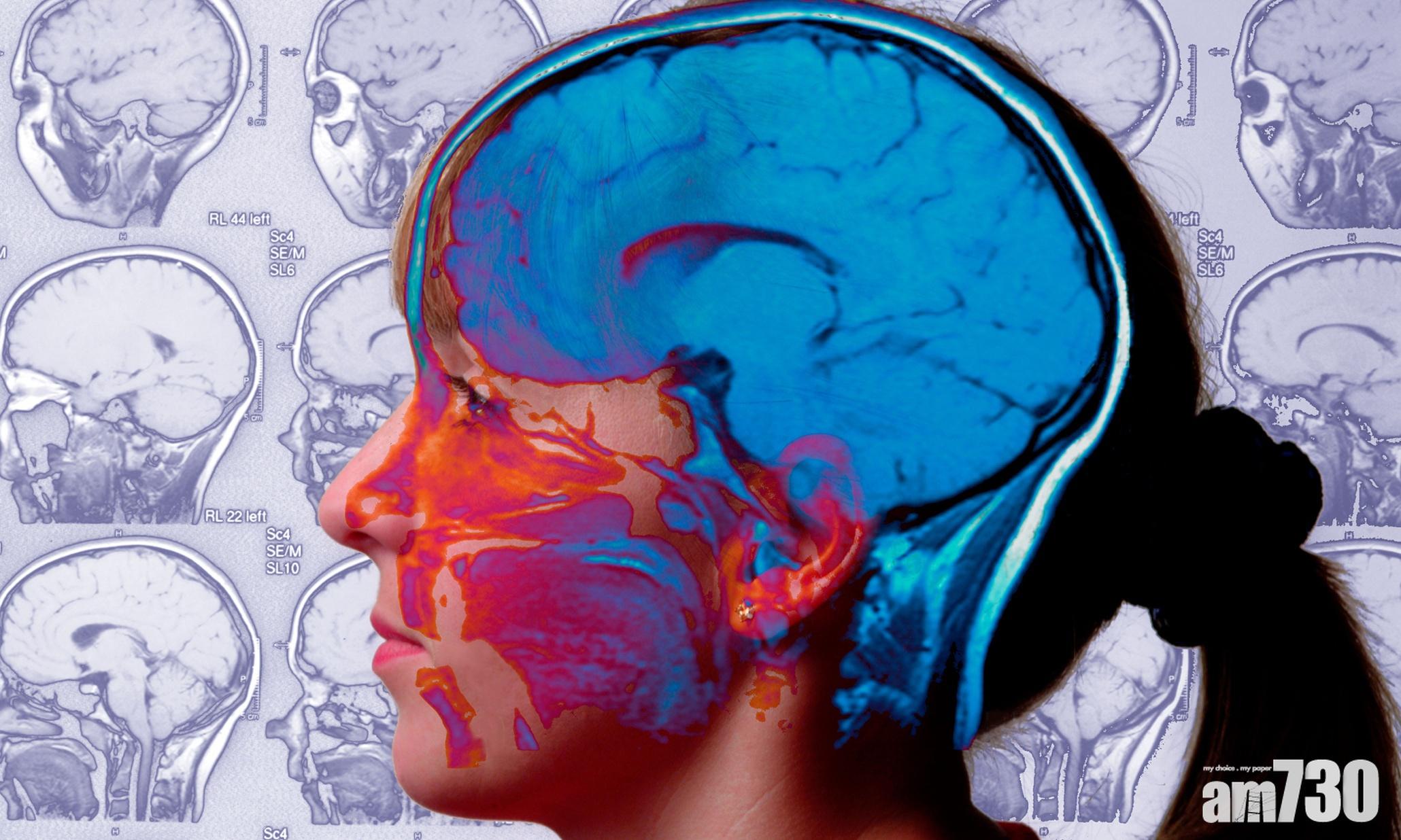 大腦蘊藏奧秘,一直是科學家樂於深入研究的課題。(互聯網圖片)