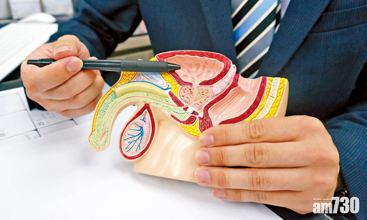 膀胱不由自主收縮,便會引致尿頻。