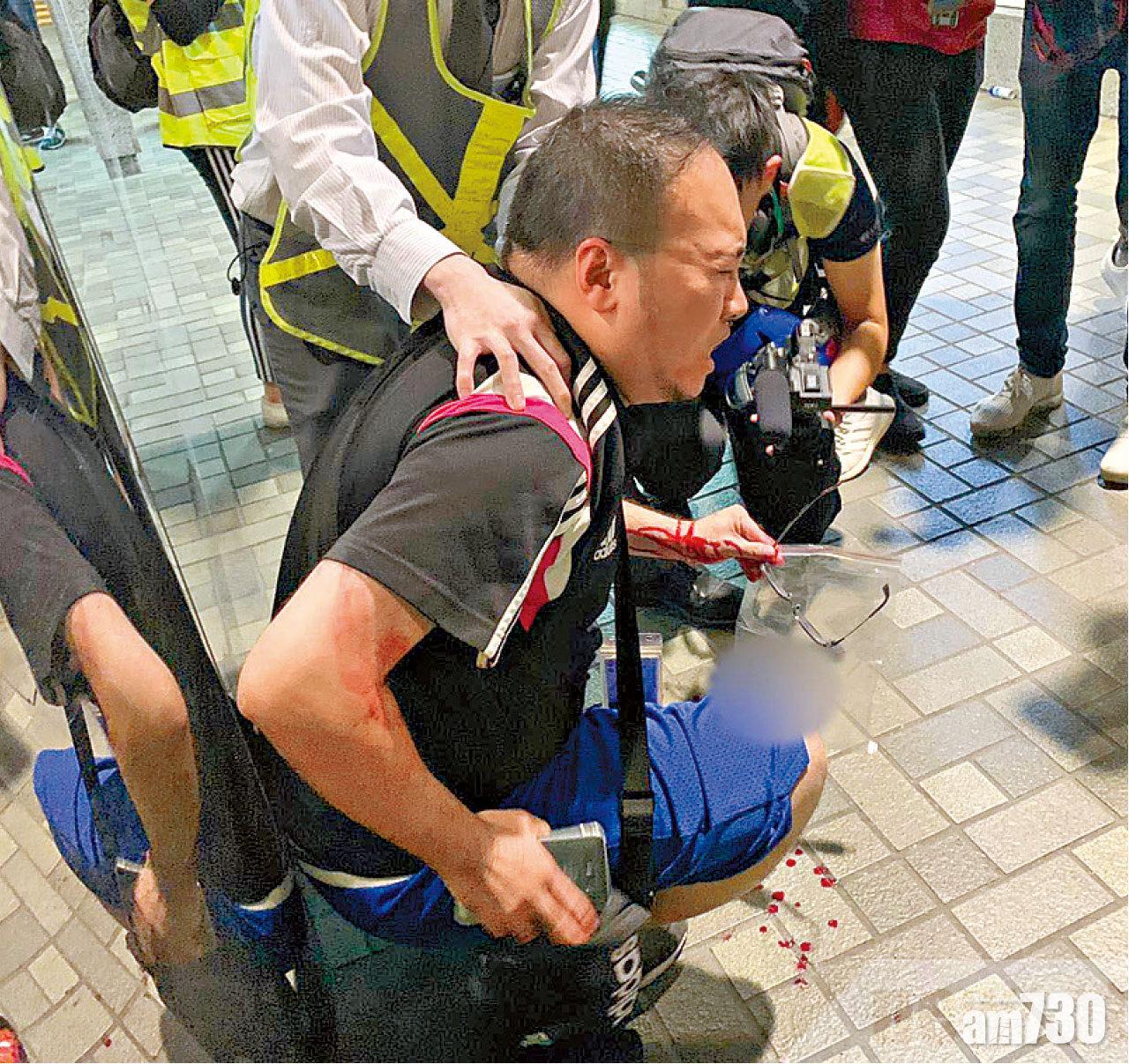 趙家賢前日被狂漢咬甩左耳,地上遺下血漬。(港台圖片)