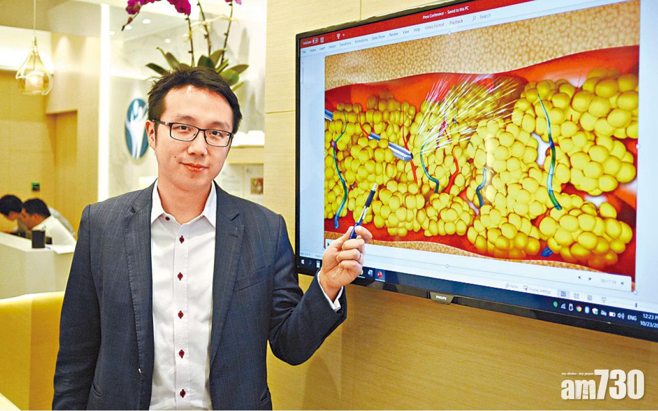 陳肖龍指,不少植入假體的人士,在二十多年後都會取出,變相要做多一次手術;如採用自體脂肪移植就沒有這煩惱。