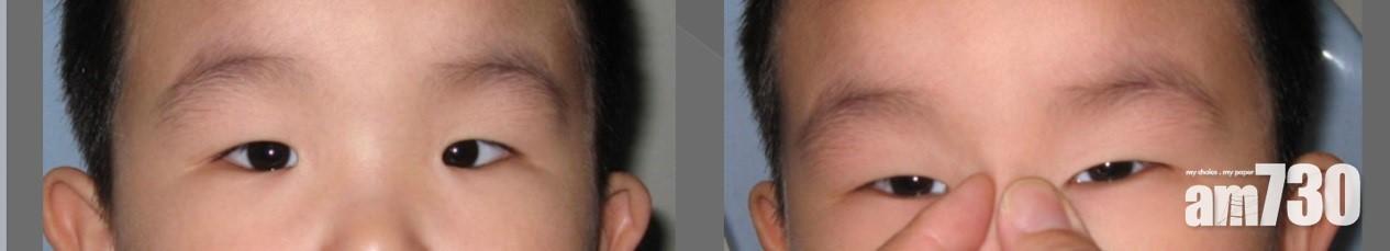 瞬眼看似有鬥雞眼,但實際上是假鬥雞,因為光的反射在眼的正中央位置。