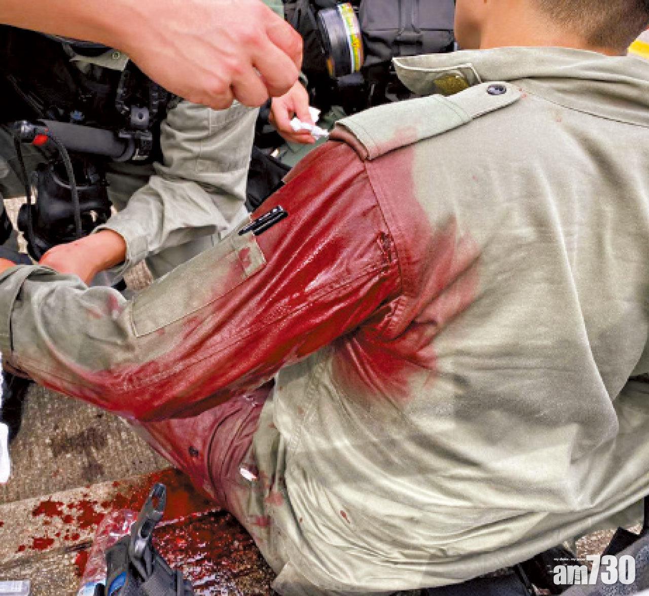 警方指昨有7名警察受傷。