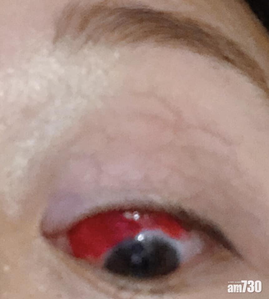 眼睛有事,非同小可!