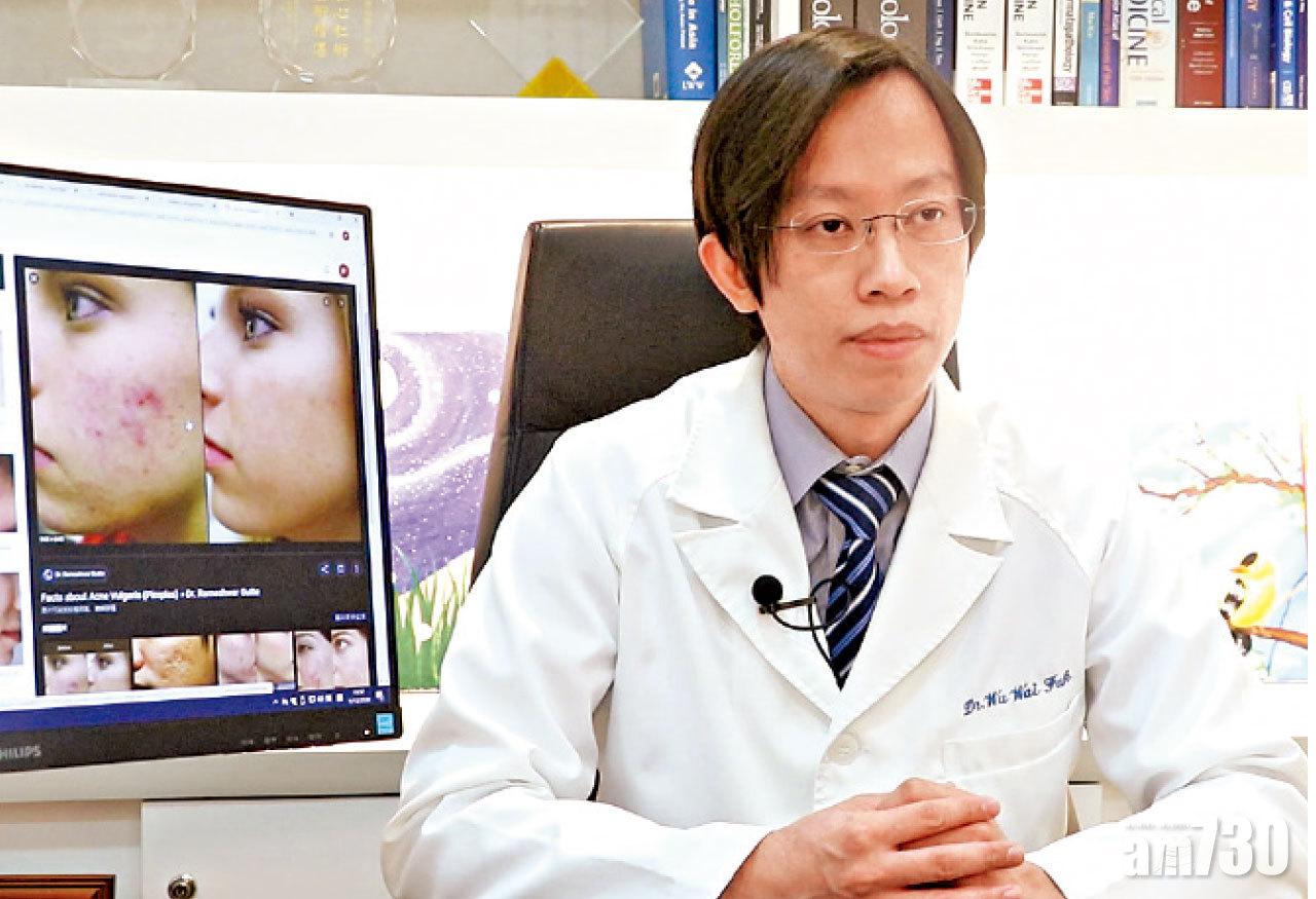 胡惠福指如暗瘡情況嚴重,應求醫而非自行買外用藥膏,因為未必有效。