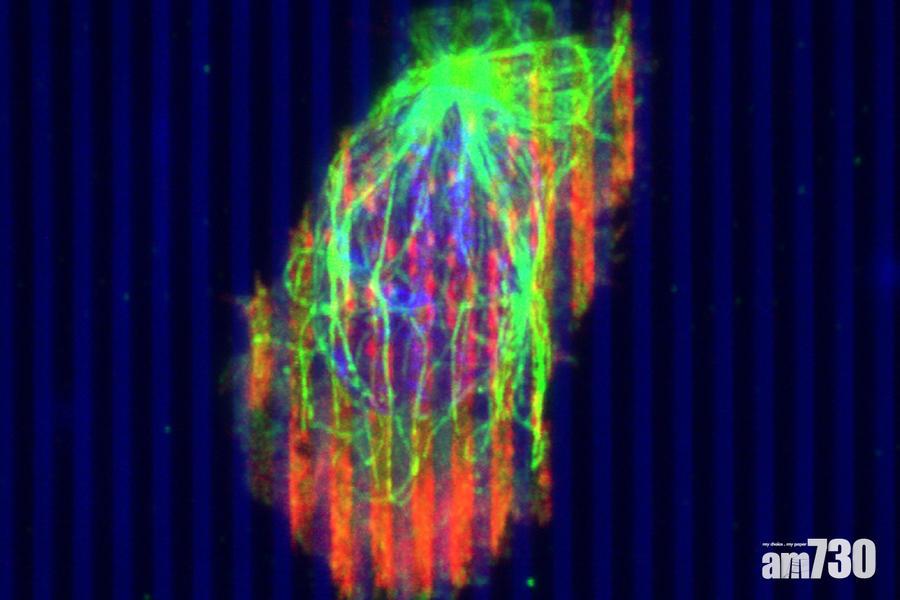 圖中細胞毒性T細胞正穿透胰腺腫瘤。(明尼蘇達大學雙城分校)