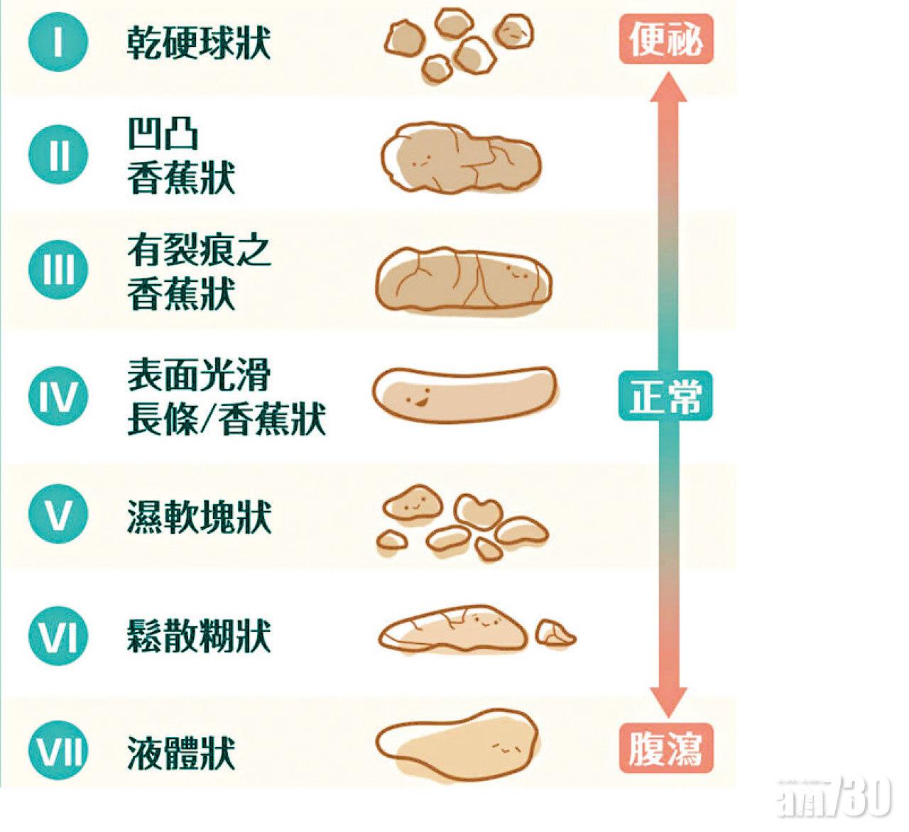 比較布里斯托大便分類法,可得知自己大便狀況。