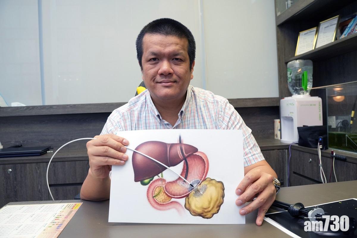 腸胃肝臟科專科黎獻醫生指,採用新式支架技術治療急性胰臟炎,手術次數和風險都大大降低,就算長者亦可接受。