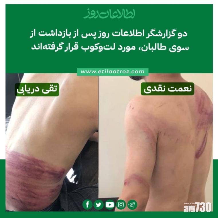 有記者被捕後獲釋,並上載照片指遭塔利班毆打。(網上圖片)