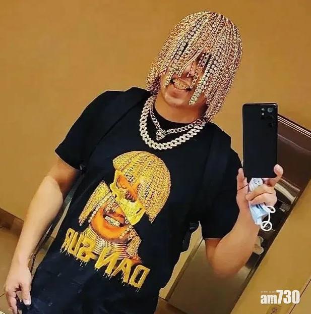 Dan Sur在IG晒出以多條金鏈植入頭皮造成的金髮。(互聯網)