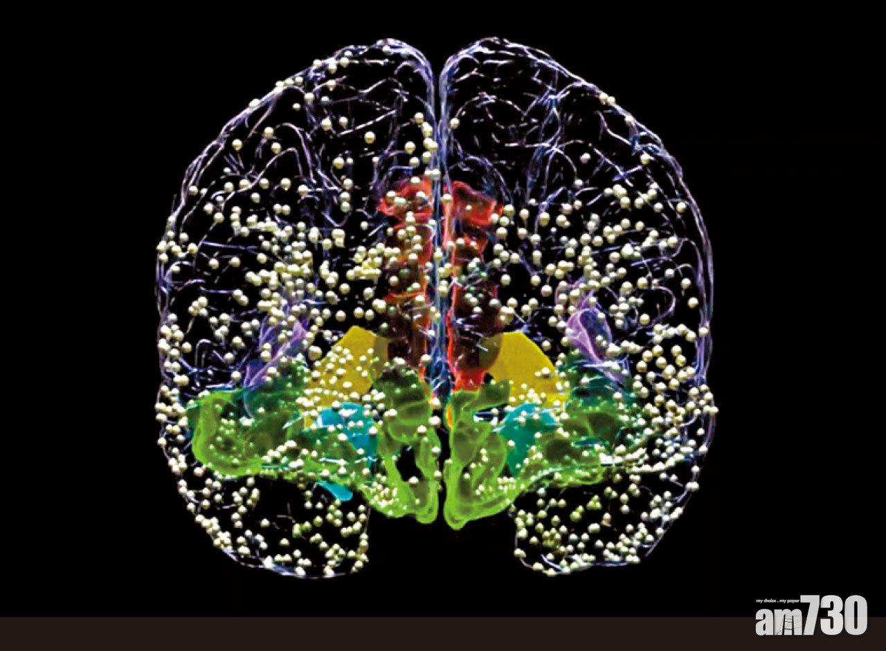 抑鬱症成因是腦部傳遞化學物質失衡,不能單靠重拾開朗便康復。