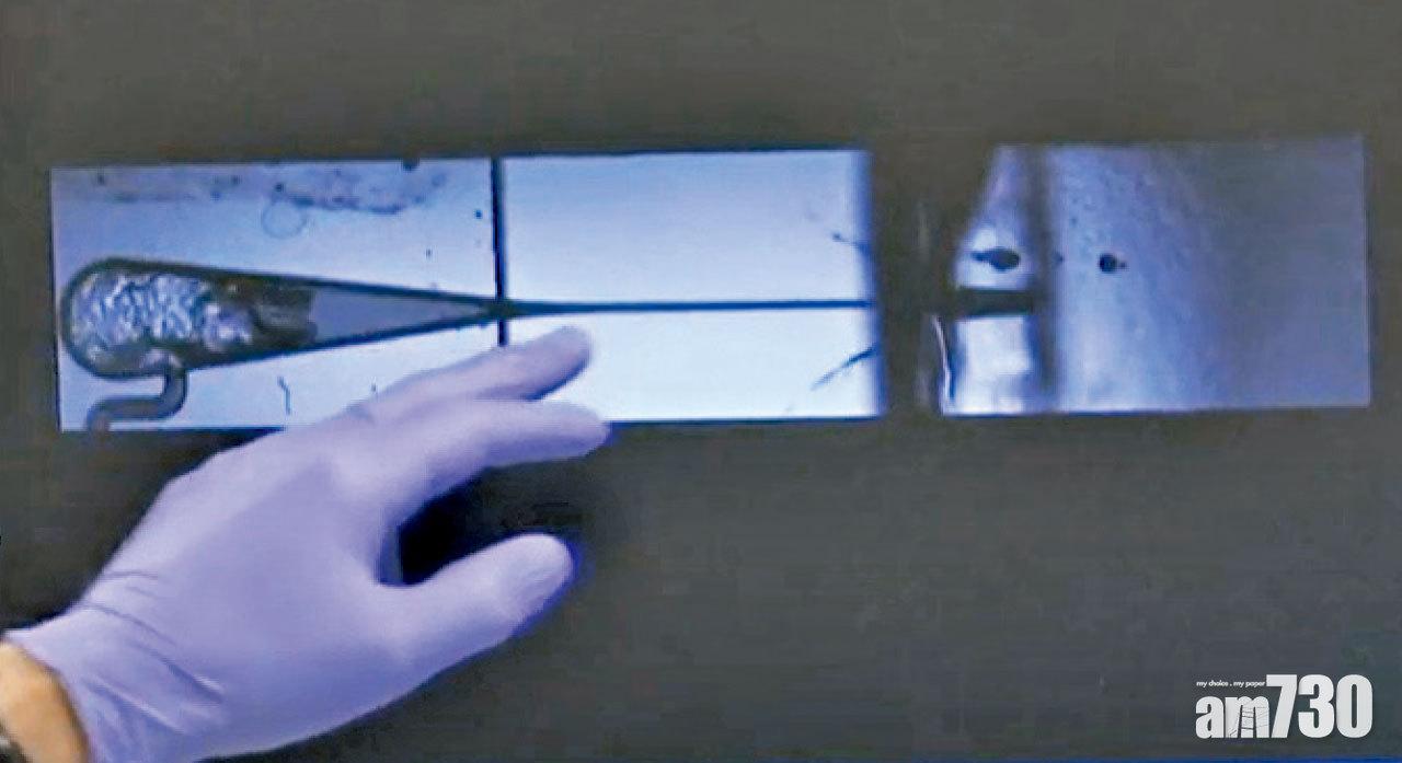 氣泡把注射液「谷出」,射進皮膚。