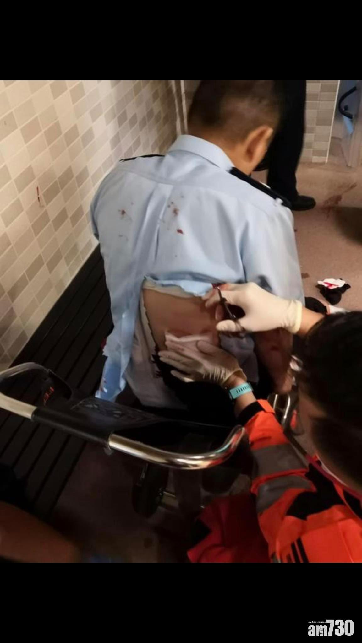 北角野豬咬傷輔警,血流如注,小腿傷口見骨。(網上圖片)