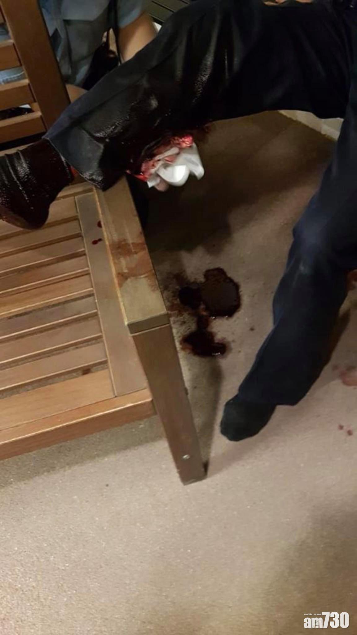 北角野豬咬傷輔警,血流如注,小腿傷口見骨。(網上圖片)