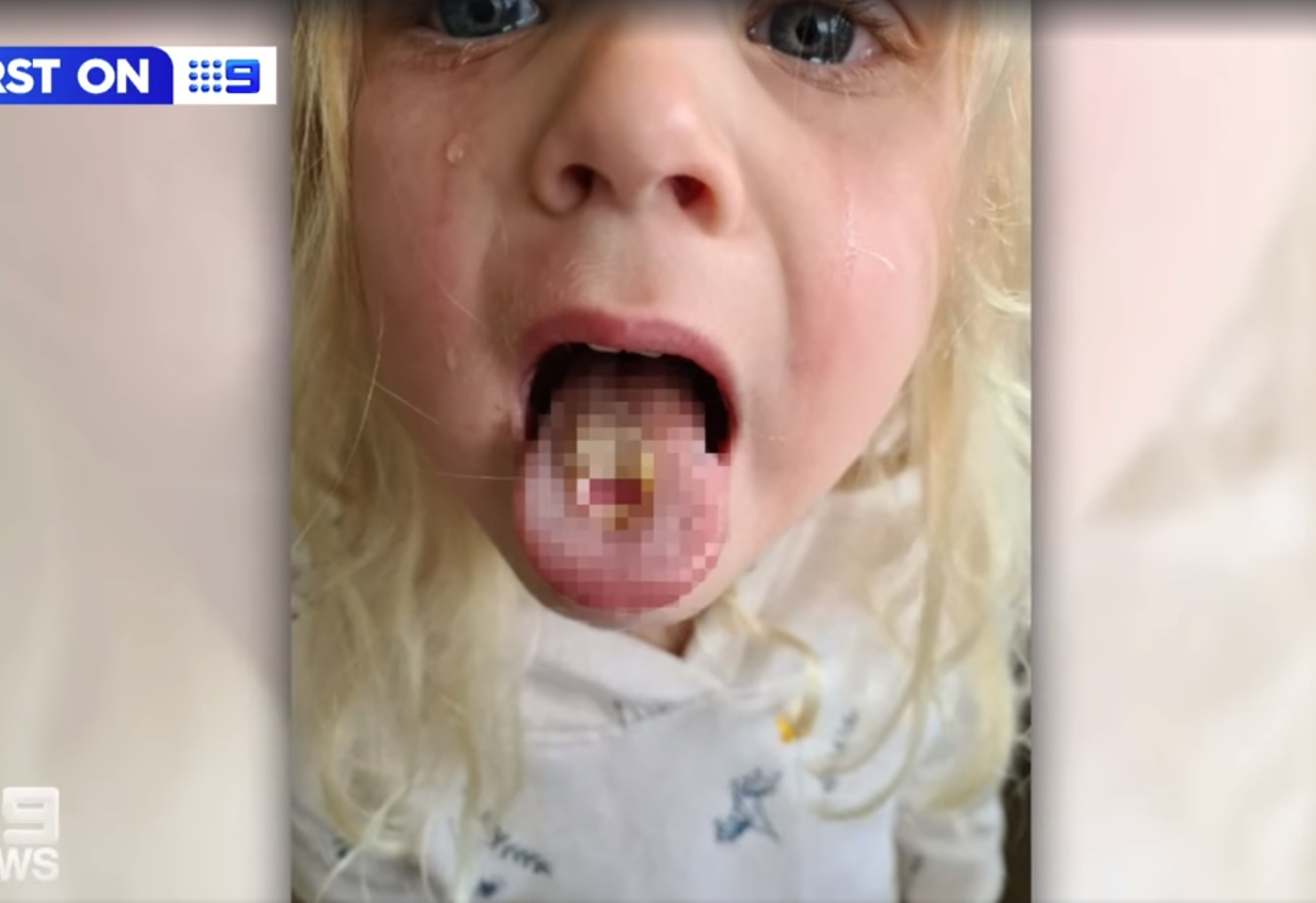 Willow Wright當日哭訴條脷好痛。(互聯網)