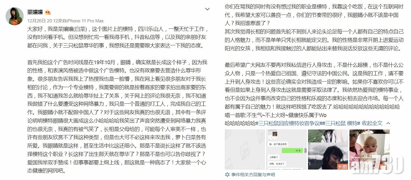 廣告中的矇豬眼模特兒發文批評網民上綱上線。