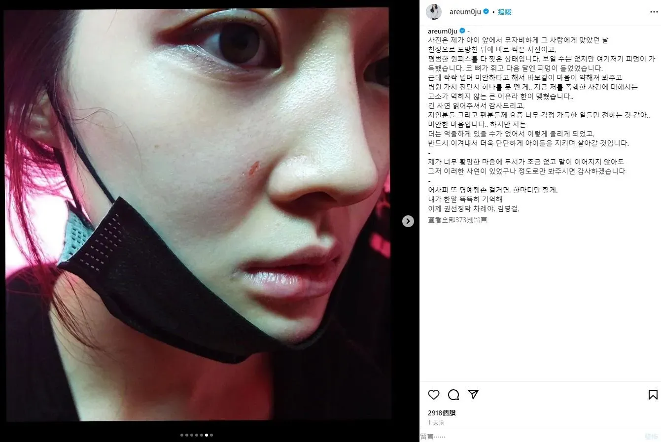 韓國媒體《OSEN》報道,南韓女子組合前T-ara成員雅凜於今日(27日)企圖自殺。