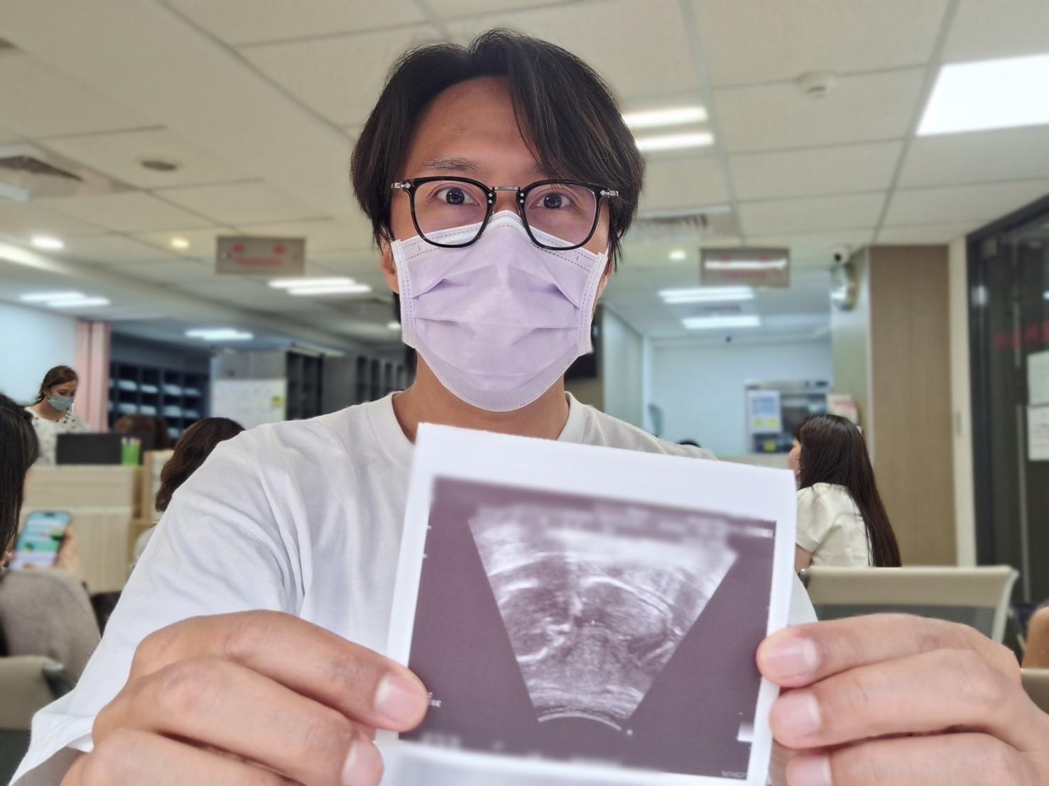 張啟樂開心宣布愛妻懷孕 曬超聲波相稱:完全是意外驚喜!