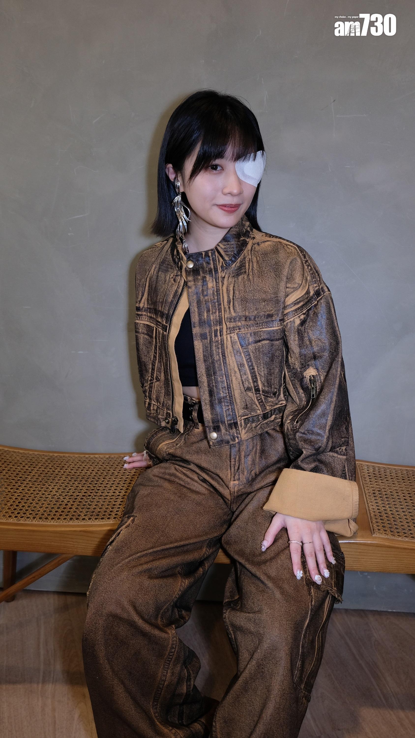 Sica受訪前一晚被小昆蝆叮眼,要負傷工作。