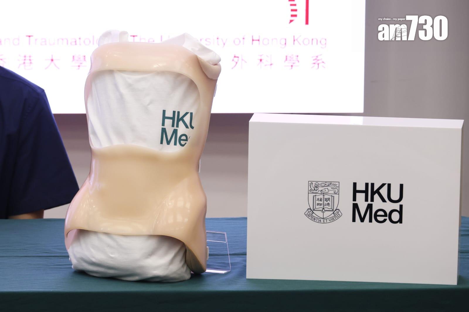港大研究:青少年原發性脊柱側彎臨床證實,即時停戴矯正器效果佳。(林俊源攝)