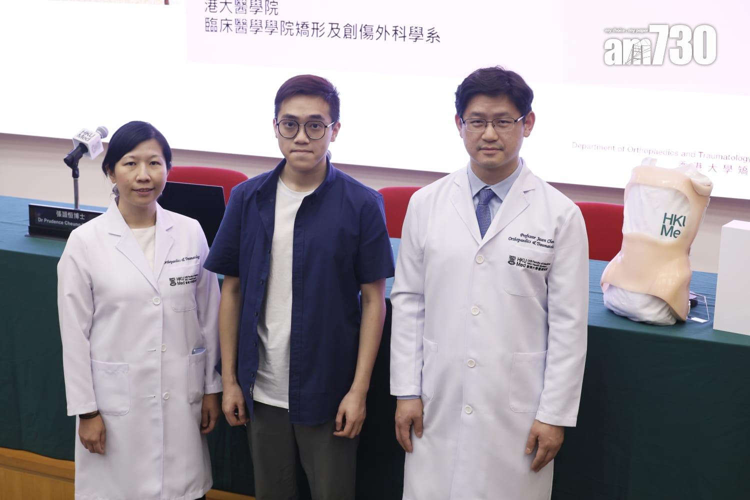 港大研究:青少年原發性脊柱側彎臨床證實,即時停戴矯正器效果佳。(林俊源攝)