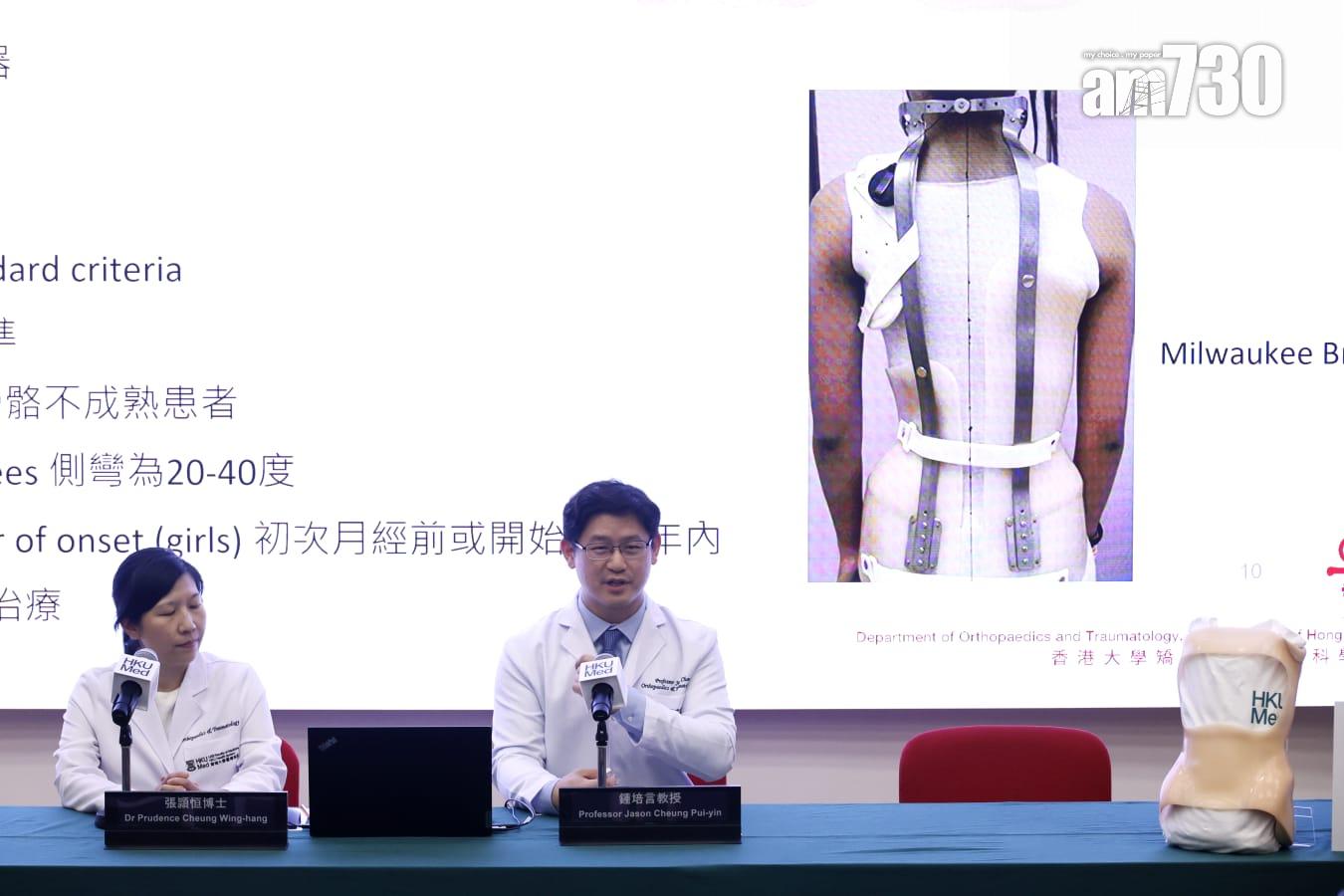 港大研究:青少年原發性脊柱側彎臨床證實,即時停戴矯正器效果佳。(林俊源攝)