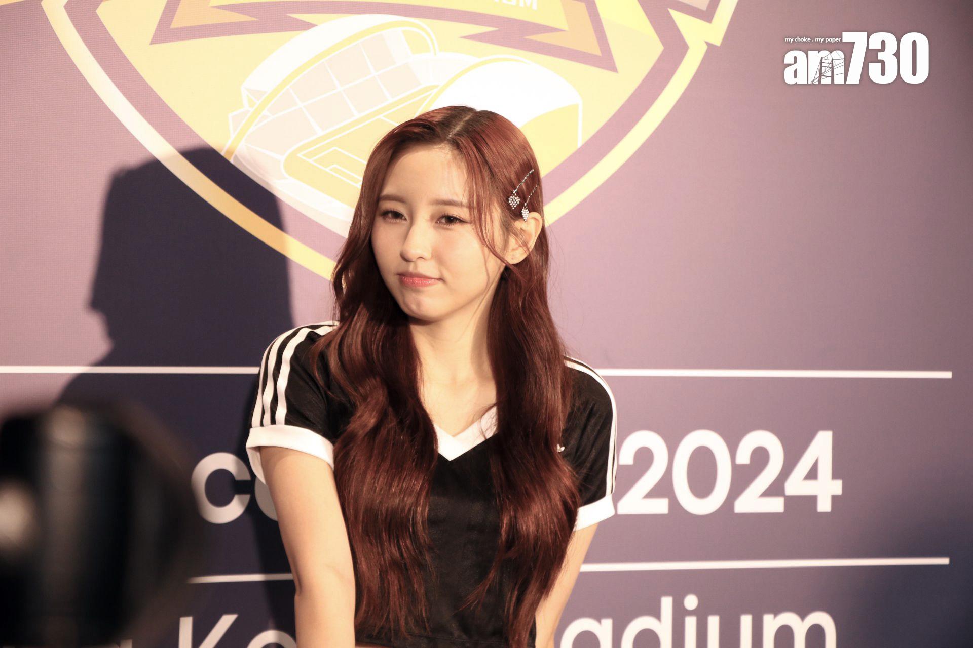 Ivy So膝蓋位置有一個疤痕,原來是拍攝《飛黃騰達》時踩單車仆倒所致。(Agly攝)