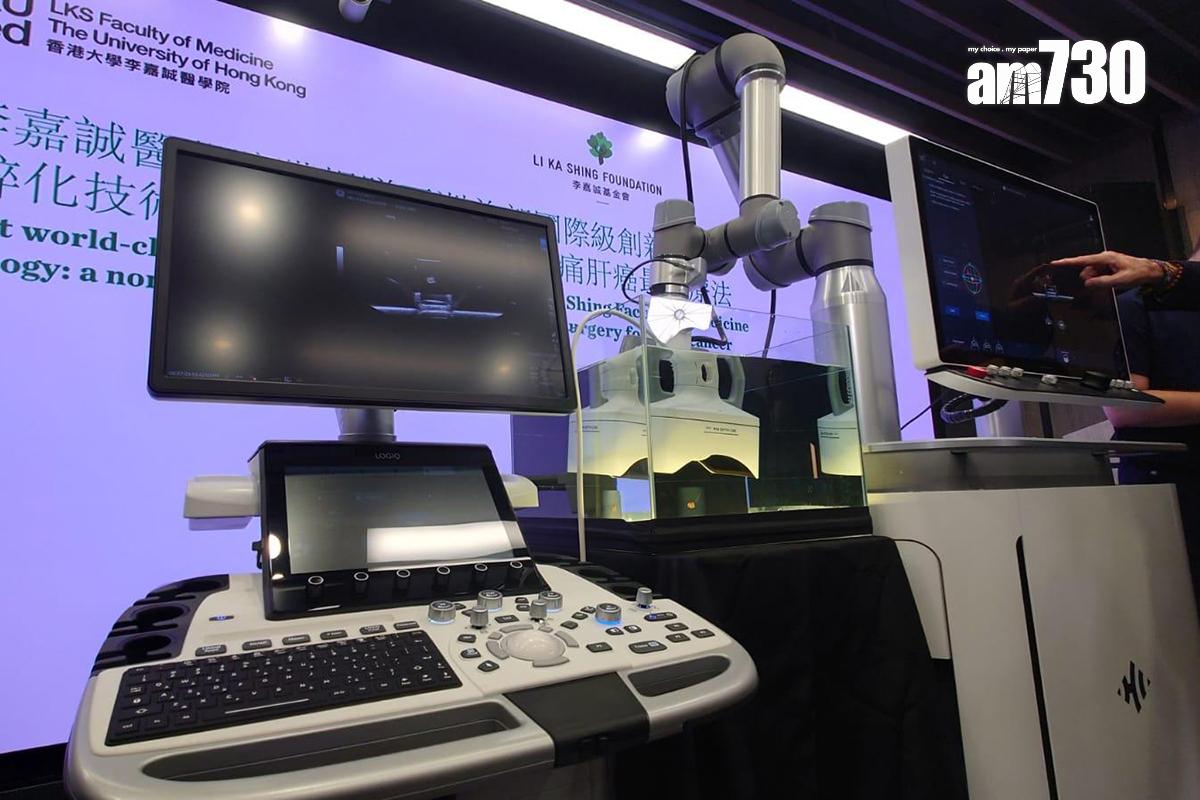 港大醫學院獲李嘉誠基金會捐贈Histotripsy系統。(資料圖片/陳易生攝)