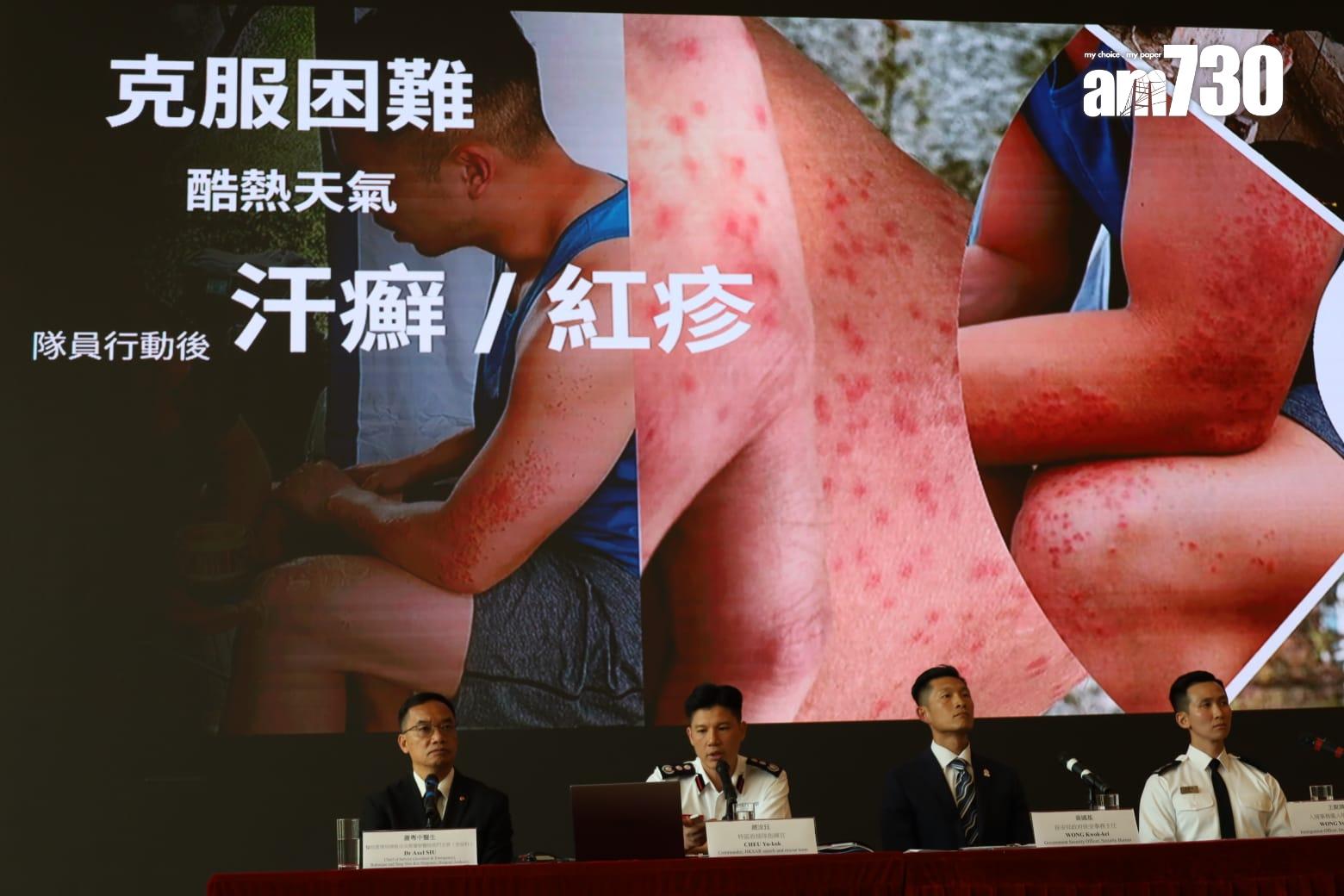 天氣酷熱令隊員出汗癬和紅疹。(鍾式明攝)