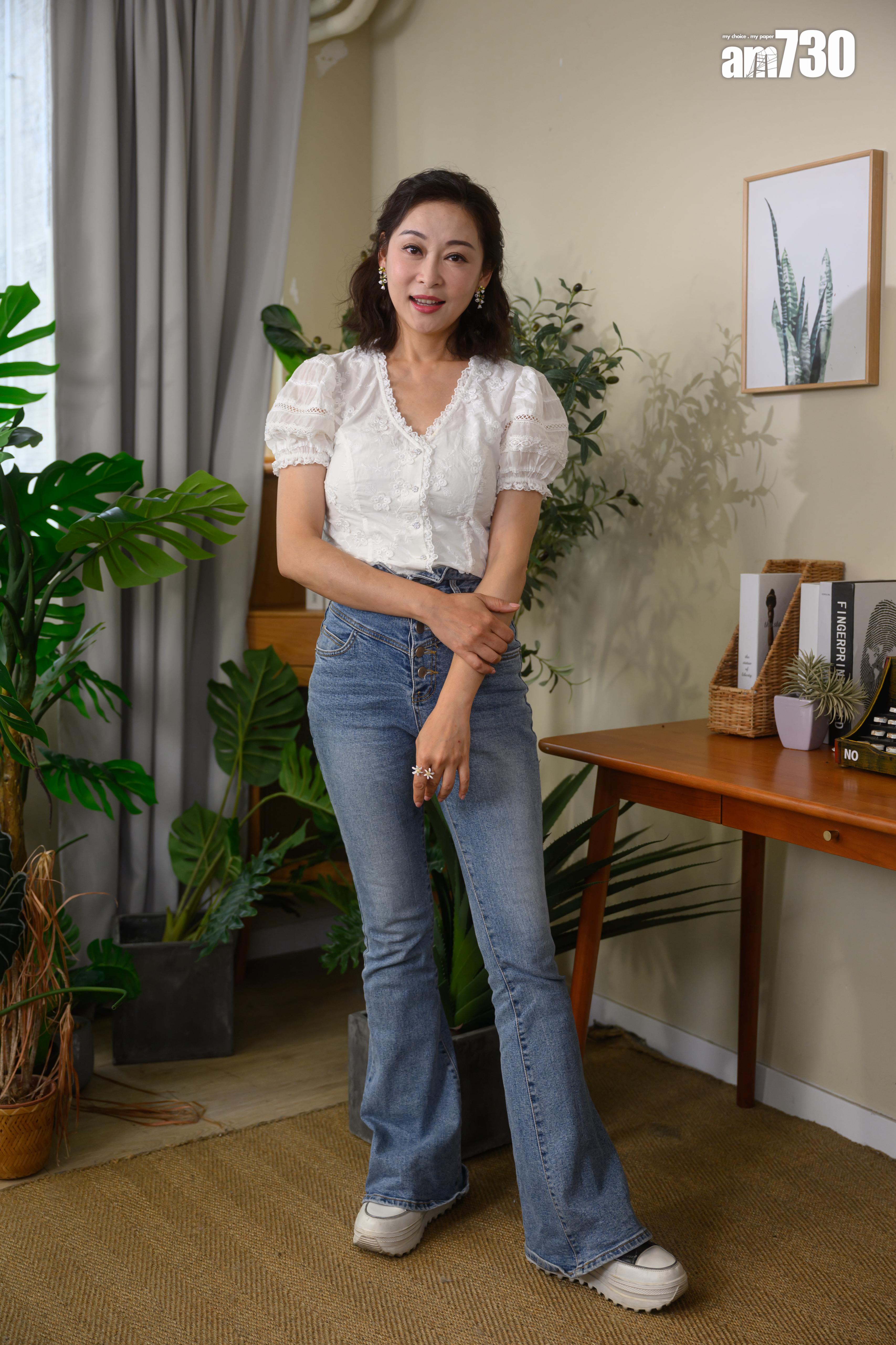 楊卓娜左額位置仍見到有一個凹陷位置。(娛樂組攝)