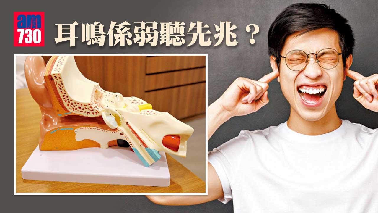 耳鳴是弱聽先兆