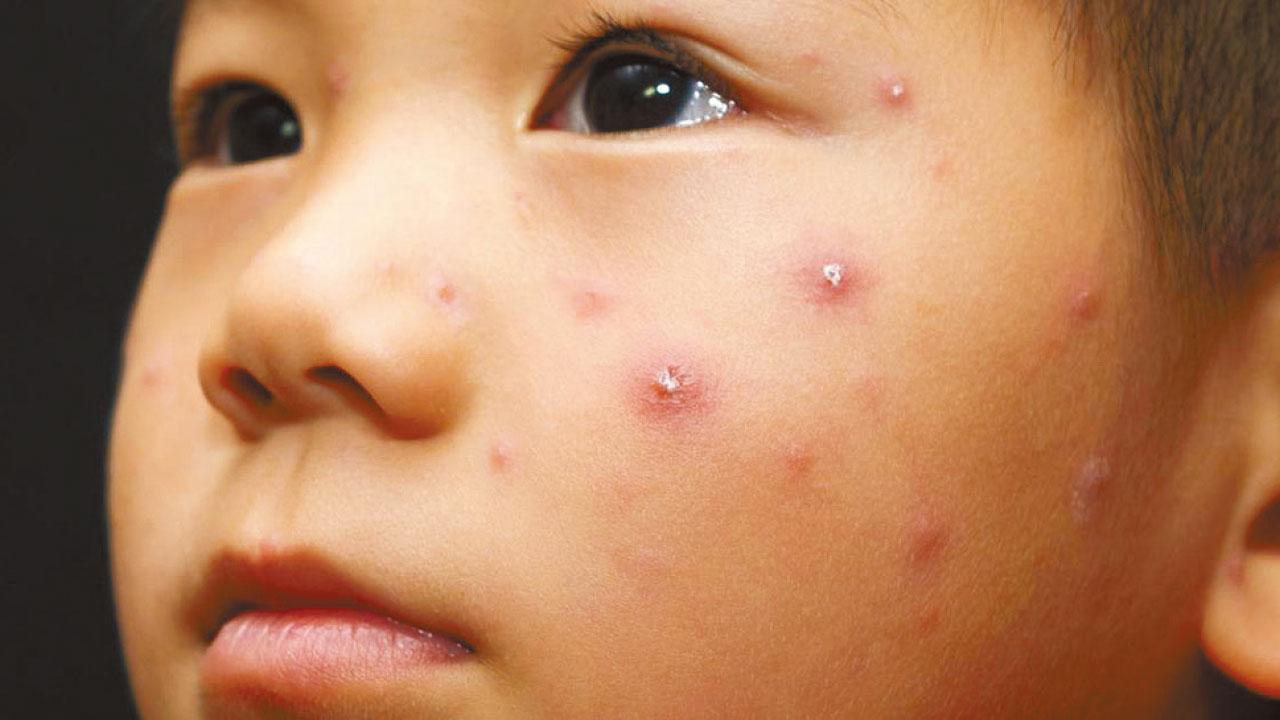 心情低落生暗瘡