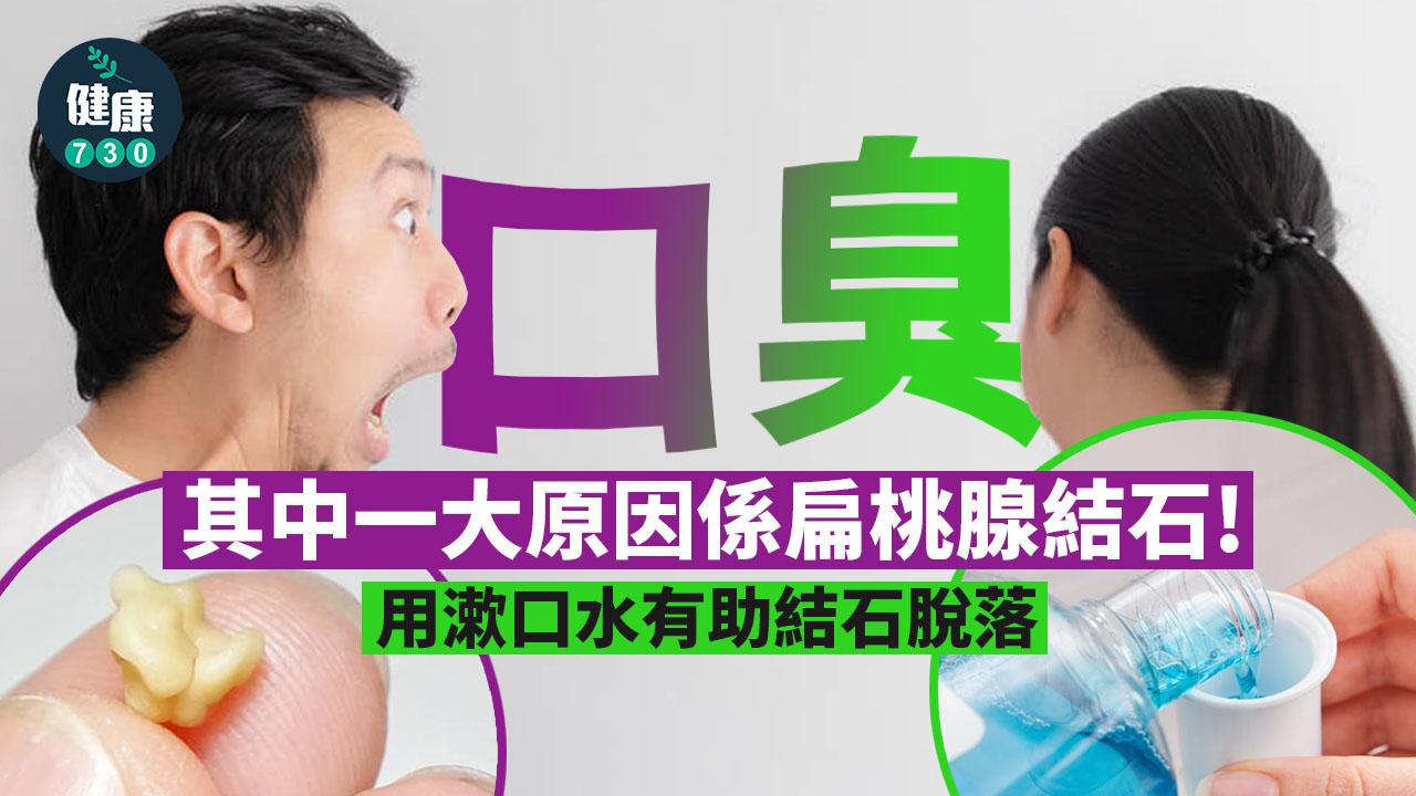 口臭｜點樣對付扁桃腺結石？