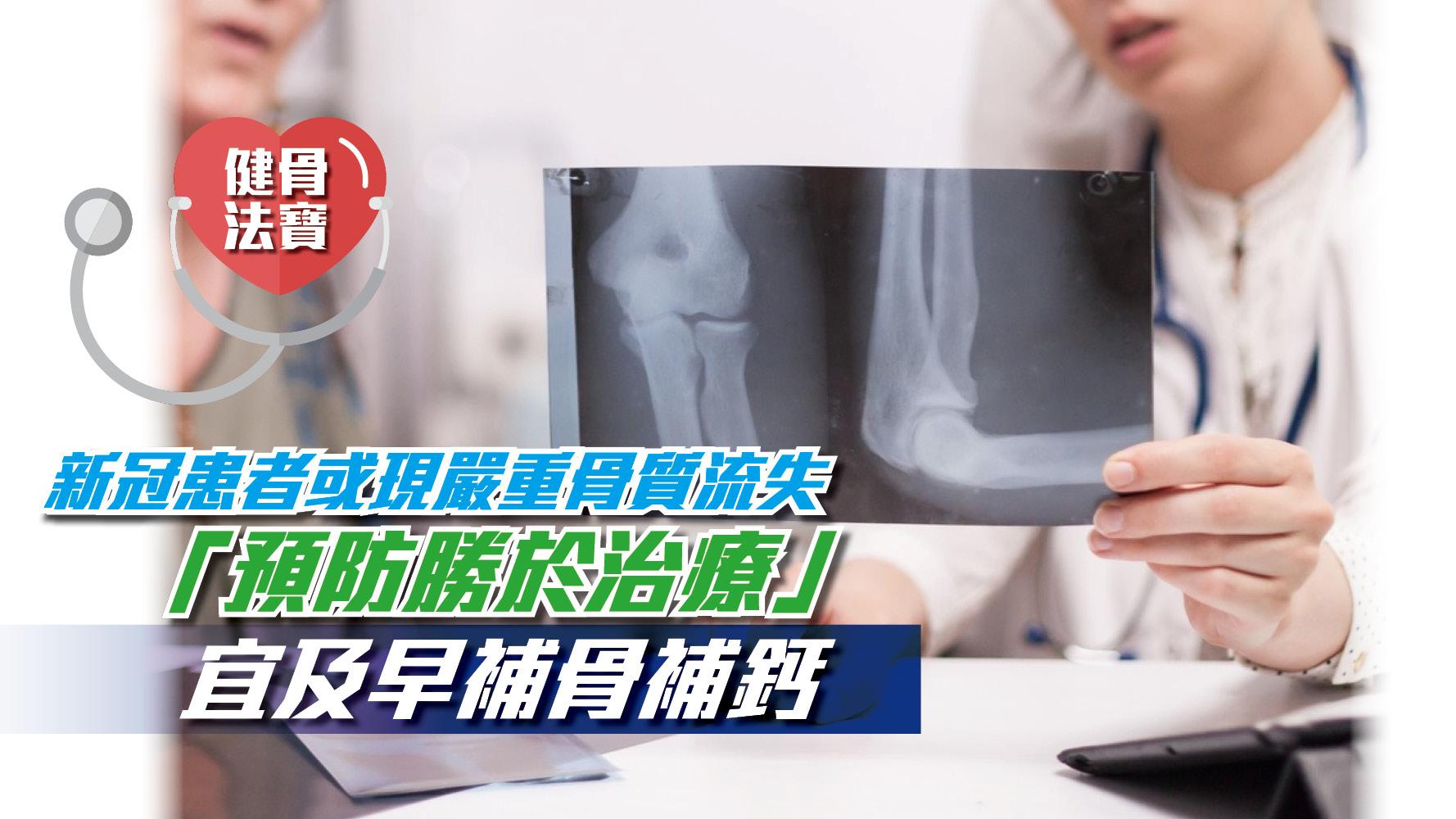 健骨法寶 | 新冠患者或現嚴重骨質流失 「預防勝於治療」宜及早補骨補鈣