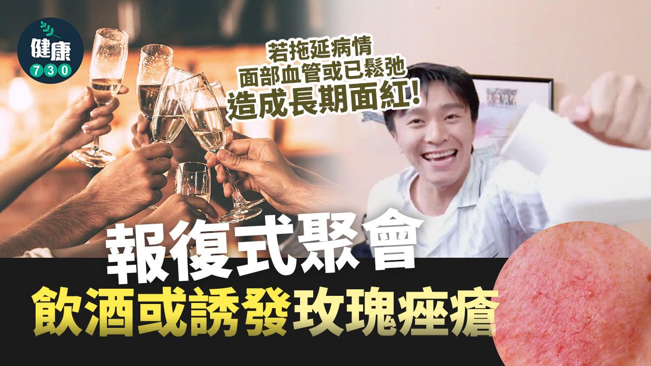 報復式聚會 飲酒或誘發玫瑰痤瘡