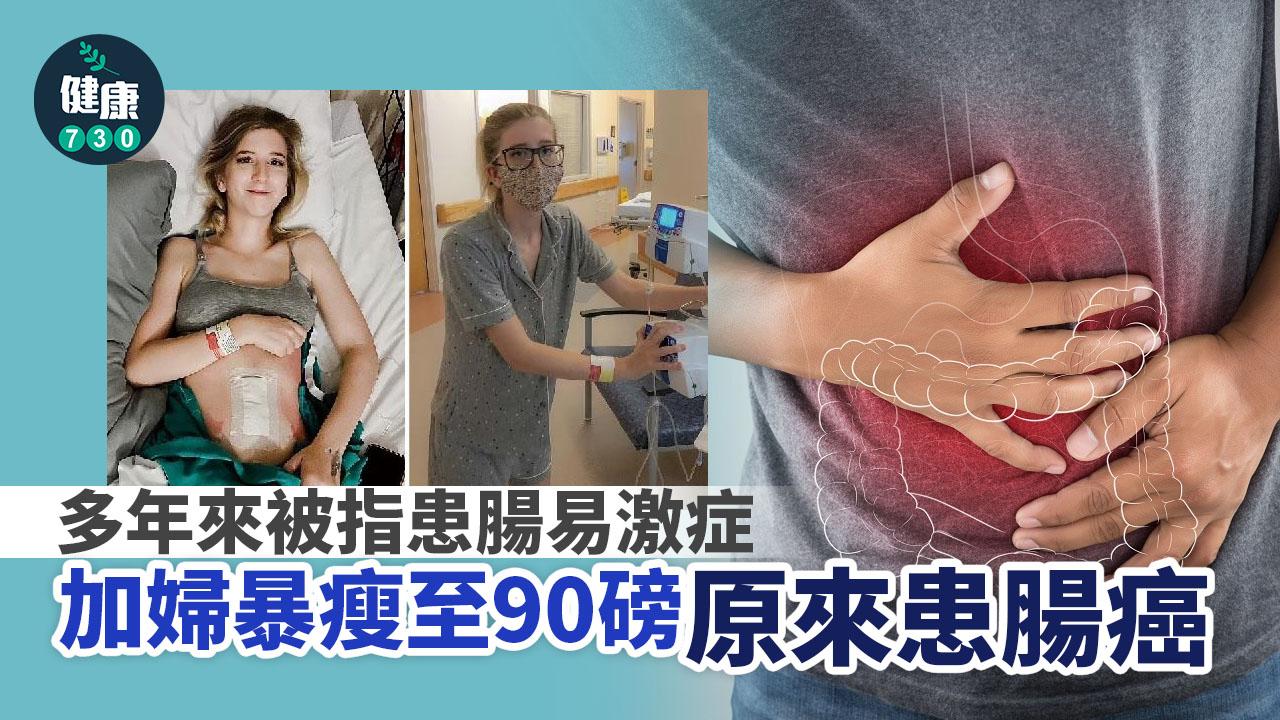 被診斷腸易激症 加婦暴瘦至90磅原來患腸癌
