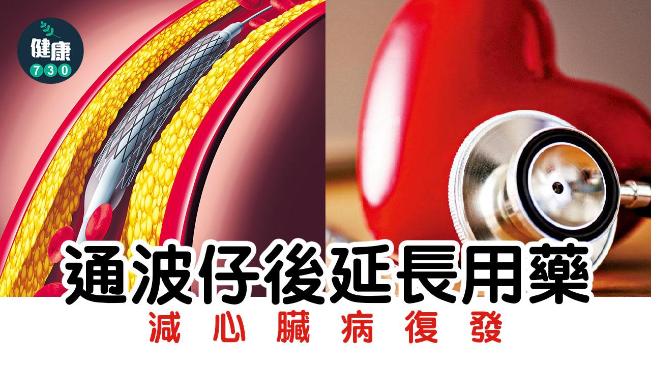 通波仔後延長用藥 減心臟病復發