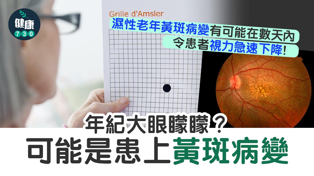 眼疾｜勿輕視黃斑病變 無及時治療可致盲