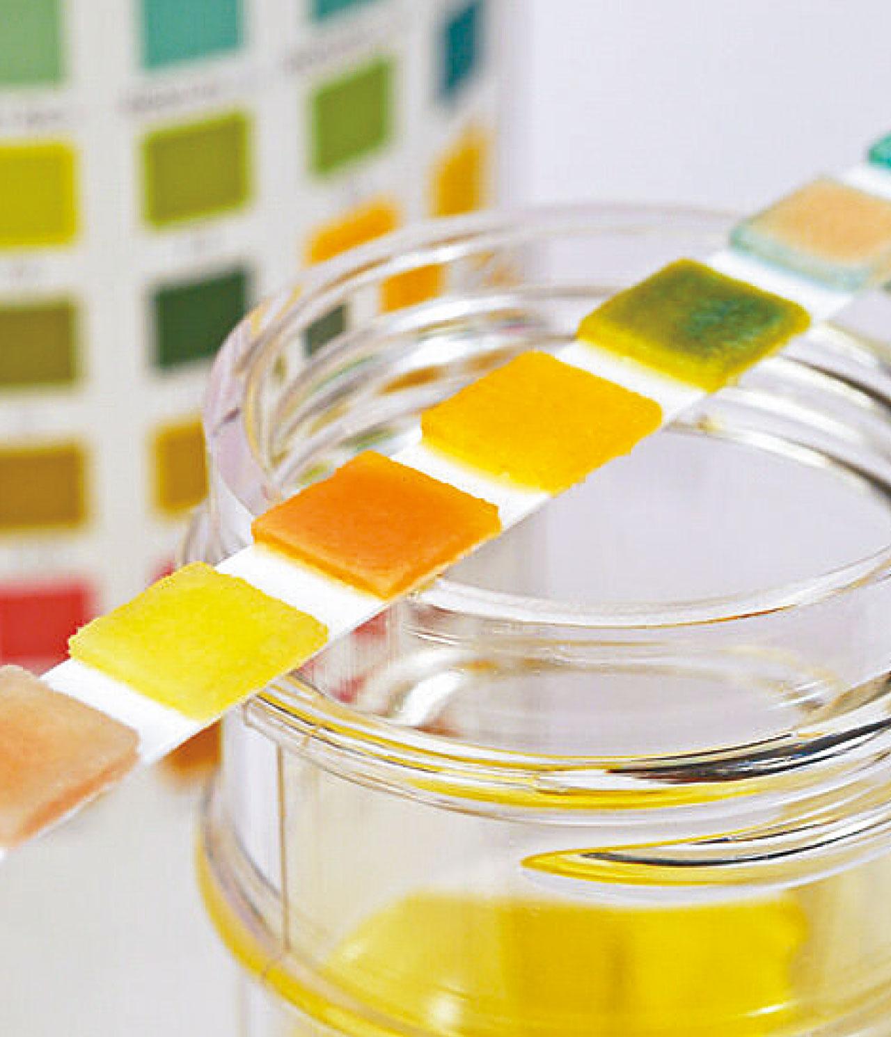 小便泡沫多是蛋白尿嗎？