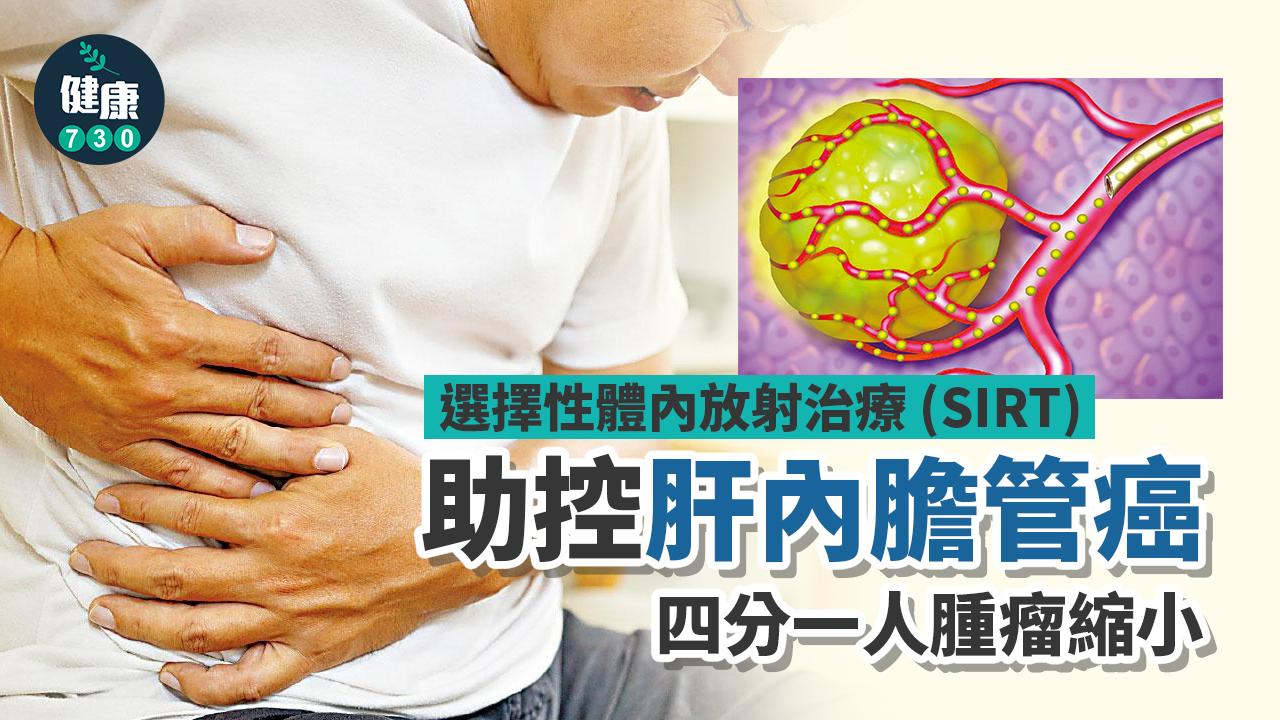 SIRT助控肝內膽管癌