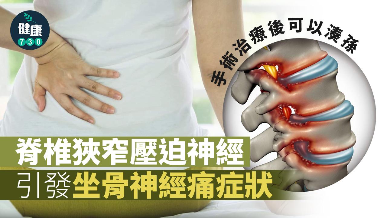 婆婆長期坐骨神經痛 手術治療後可以湊孫