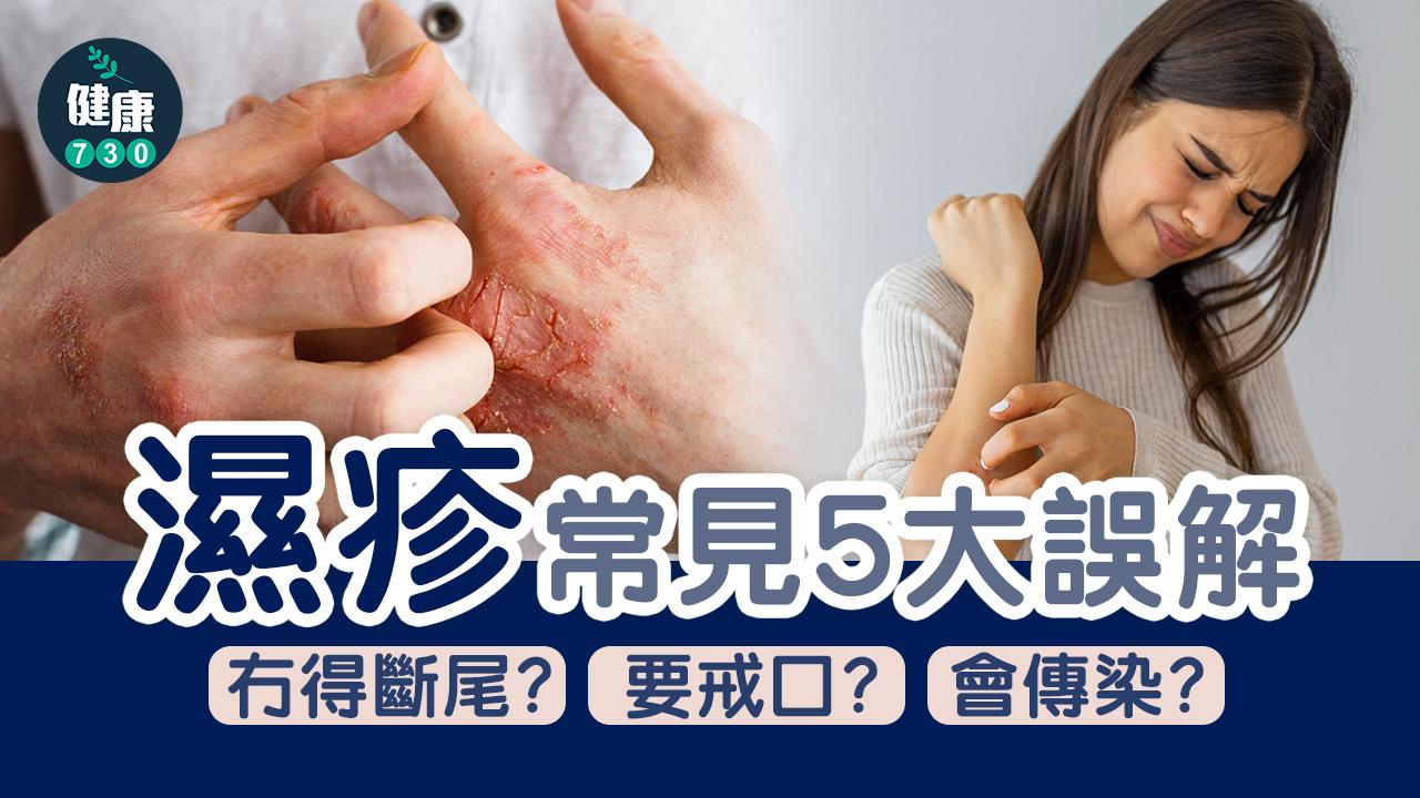 拆解濕疹常見5大誤解
