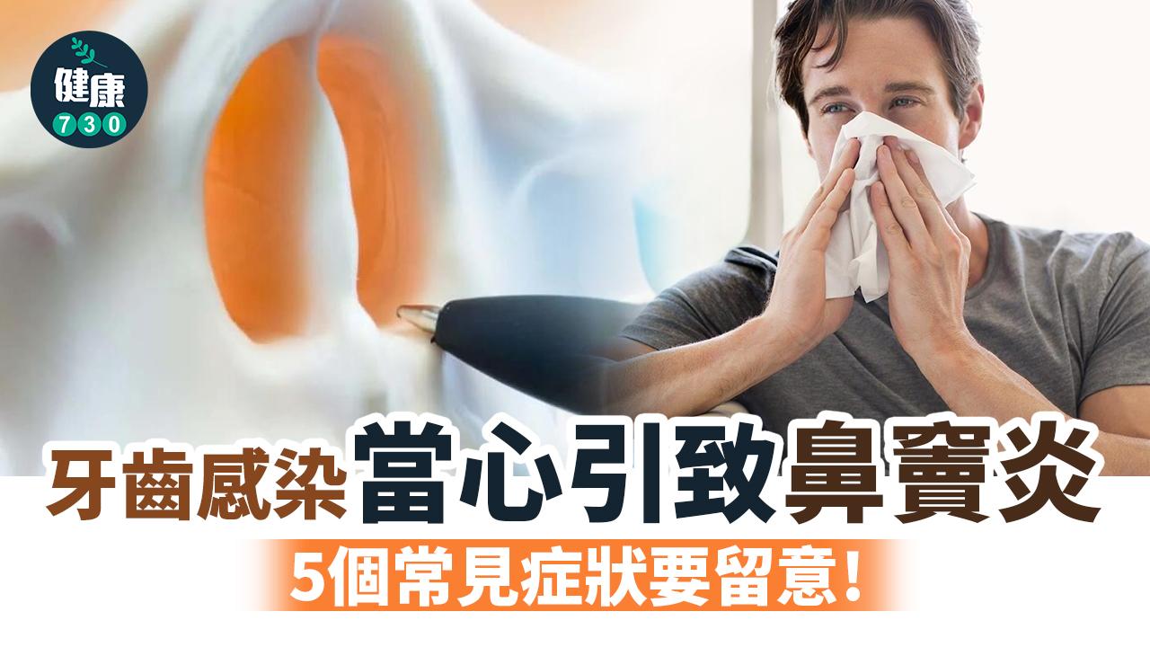 牙齒感染當心引致鼻竇炎！流惡臭膿黃鼻涕注意