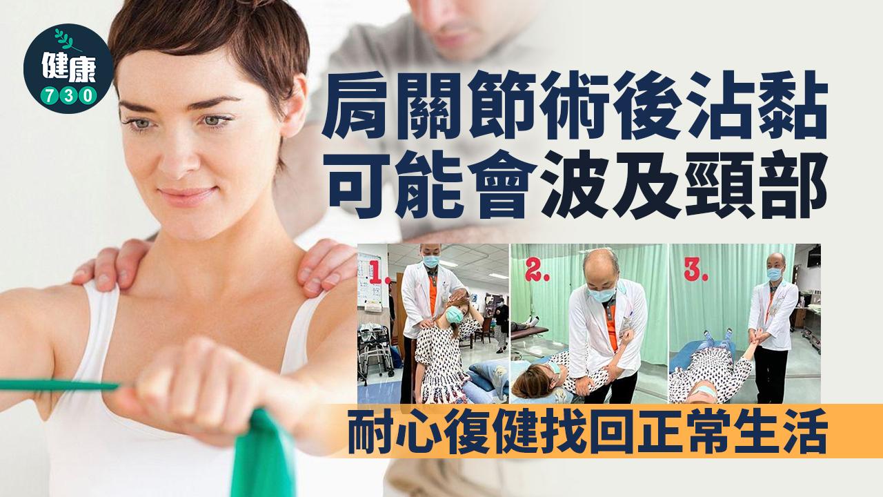 肩關節術後腫脹沾黏 積極配合復健終重返工作崗位