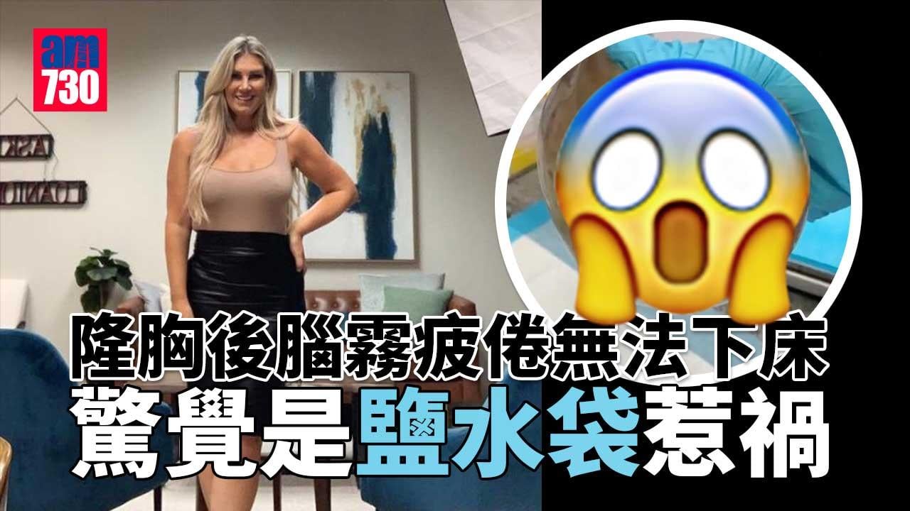 貪靚女隆胸後出現腦霧疲倦抑鬱暴肥症狀 驚覺是鹽水袋惹禍 拆彈後即刻舒服晒