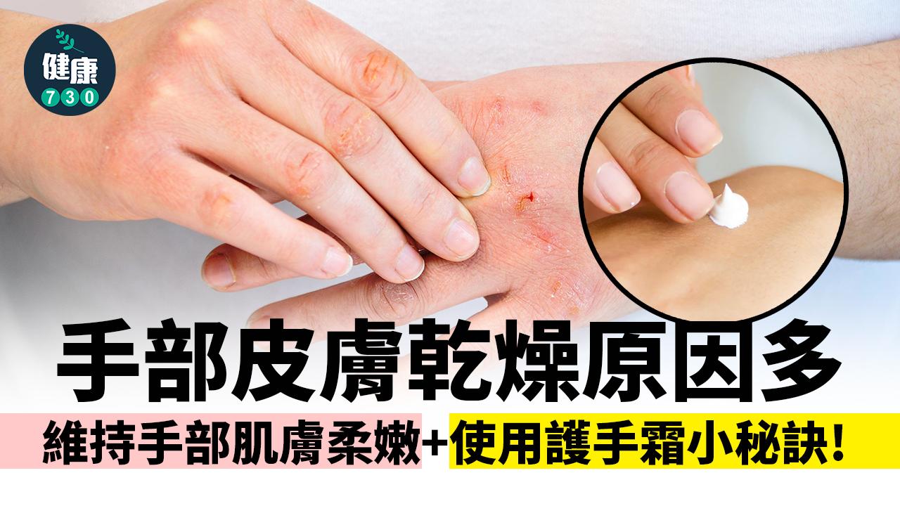 壞習慣令雙手粗糙！使用護手霜兩秘訣