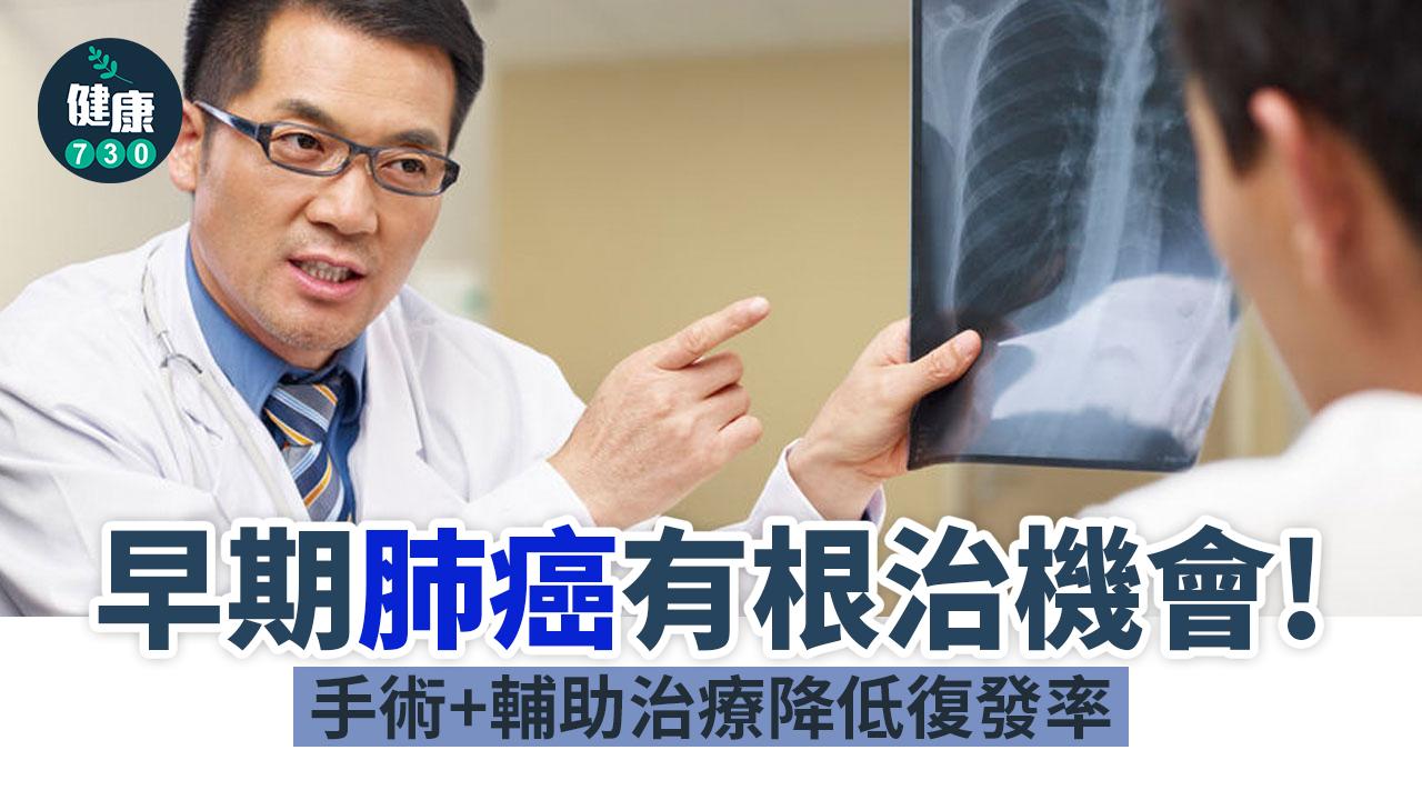 定期檢查！早期揪出肺癌「手術＋輔助治療」減復發率