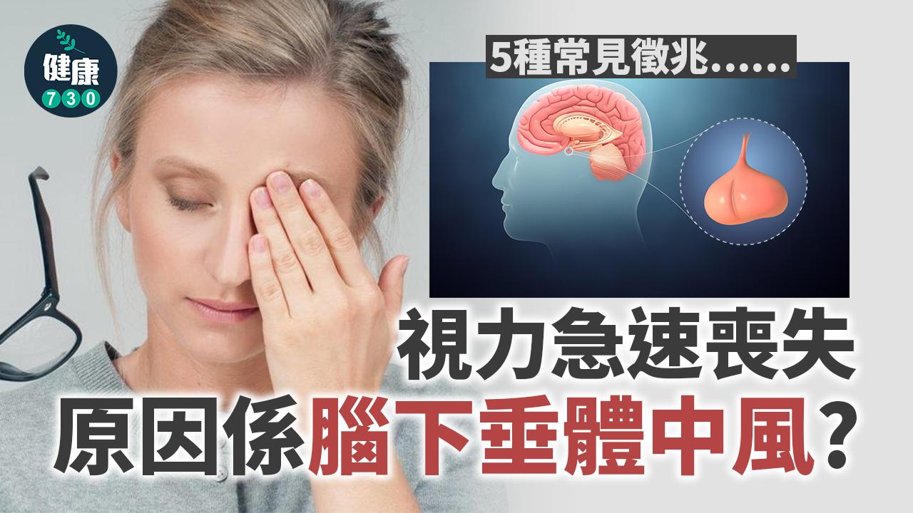 視力急速喪失 原因係腦下垂體中風？