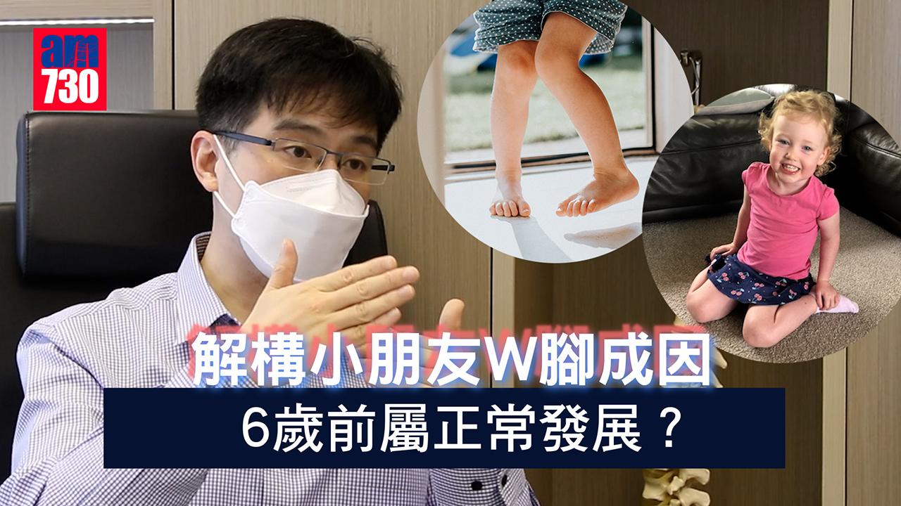 解構小朋友W腳成因 6歲前屬正常發展？