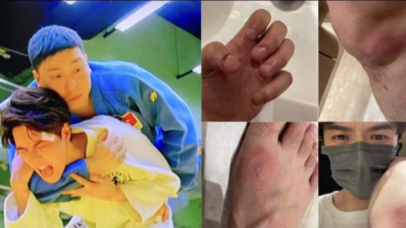 野人老師｜Frankie傷痕纍纍騷戰績  打柔道唔簡單