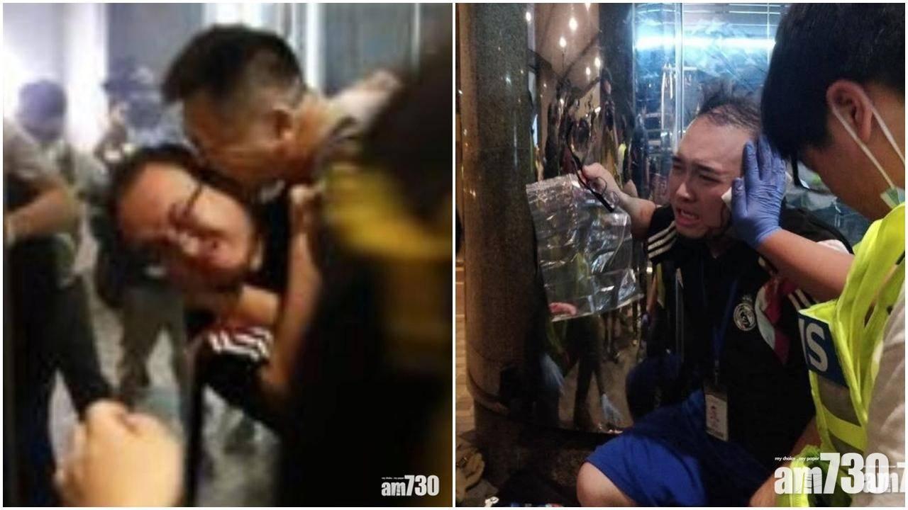 修例風波｜咬甩趙家賢耳遭「私了」　陳真獄中向施襲者索償